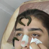 طب سنتی سیاتیک کمر درد دیسک بادکش حجامت زالو فصد|خدمات آرایشگری و زیبایی|ملارد, |دیوار