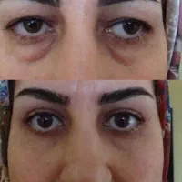 دیگه نیاز به عمل و جراحی نیست