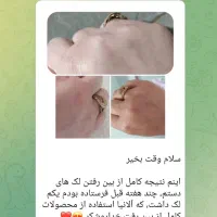 پوستت هلوی با تکسو|خدمات آرایشگری و زیبایی|کرمان, |دیوار