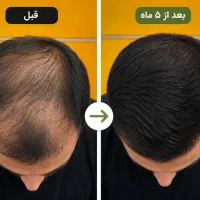 چهره ای متفاوت با موهای جدید
