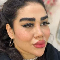 انجام خدمات ژل و بوتاکس و پیرسینگ