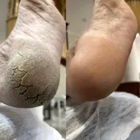 آموزش تخصصی پدیکور ( پردرآمدترین لاین زیبایی )