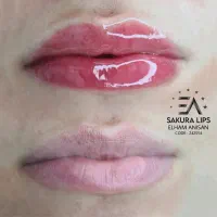 تخفیف ویژه شیدینگ لب|خدمات آرایشگری و زیبایی|بوشهر, |دیوار