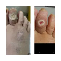 درمانگری طب سنتی