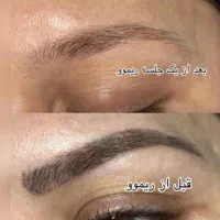 پاک کردن انواع تاتو صورت در یک جلسه|خدمات آرایشگری و زیبایی|نیشابور, دارایی|دیوار