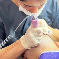 کاشت مو|خدمات آرایشگری و زیبایی|جیرفت, |دیوار