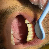 جرمگیری رایگان