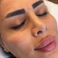 تخفیفات پاییزه   ژل ، بوتاکس ، فیلر،جوانسازی پوست|خدمات آرایشگری و زیبایی|تهران, نیروی هوایی (پیروزی)|دیوار