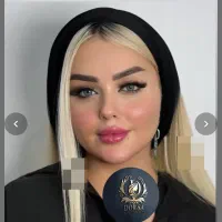 ژل وبوتاکس لیفت نخ گودی چشم لب رفع جای بخیه گونه