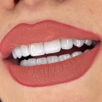 لمینیت وکامپوزیت