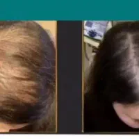 جذابیت شما در گرو مو و ریش‌های پرپشت‌تان است.