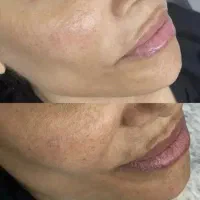 فیشیال وپاکسازی صورت فقط۶۰۰