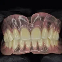 ساخت دندان مصنوعی کامل / تکه ای / تکی