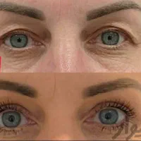 زیبائی پلک بالا و پائین|خدمات آرایشگری و زیبایی|لنجان, |دیوار