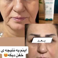 کرم جوان ساز وسفت کننده صورت|آرایشی، بهداشتی، درمانی|برازجان, |دیوار
