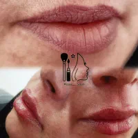 تزریق ژل و بوتاکس|خدمات آرایشگری و زیبایی|جهرم, |دیوار