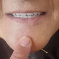 ندانسازی ۲۰درصدتخفیف|خدمات آرایشگری و زیبایی|تربت‌حیدریه, باغ ملی|دیوار