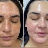 درمان گیاهی برای حل مشکلات پوستی