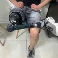 ساخت پای مصنوعی، پروتز پا،پای مصنوعی، پروتز ژله ای