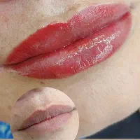 انجام خدمات شیدینگ لب