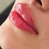 آف ویژه بالن وبوتاکس معده،ژل و بوتاکس وبفاروپلاستی|خدمات آرایشگری و زیبایی|اهواز, کیانپارس |دیوار