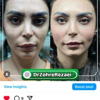 تزریق ژل از ۱۴۹۰ ،بوتاکس از ۶۵۰، پکیج فول فیس ۹/۵|خدمات آرایشگری و زیبایی|تهران, گلستان (شهرک راه آهن)|دیوار