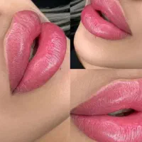 ژل و بوتاکس فیلر مزو