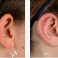 **جشنواره عمل زیبایی با قیمت‌های ویژه**|خدمات آرایشگری و زیبایی|شیراز, میرزاکوچک خان|دیوار