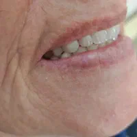 دندانسازی (فقط با ۱۵ میلیون )|خدمات آرایشگری و زیبایی|پرند, فاز ۲|دیوار