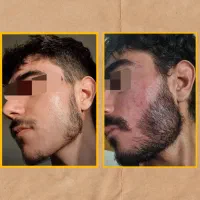 پسری که ریش نداره کنسله