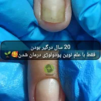 درمان بیماری های ناخن بدون جراحی درکلینیک|خدمات آرایشگری و زیبایی|ورامین, خیر آباد|دیوار
