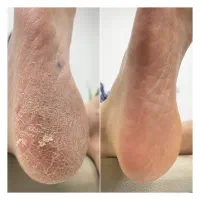 پدیکور درمانی و ریلکسی