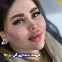 جشنواره تخفیفی ژل و بوتاکس فیلربادی prpلاغری