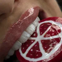 کامپوزیت دندان vip