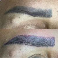 مدل رایگان ریموو تاتو قدیمی|خدمات آرایشگری و زیبایی|قشم, |دیوار