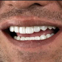 جشنواره پاییزه دندانپزشکی|خدمات آرایشگری و زیبایی|قم, آزادگان|دیوار