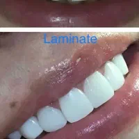 دستیار دندانپزشک