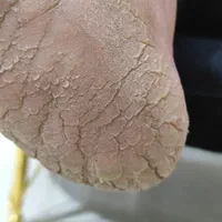 پدیکور و کفسابی|خدمات آرایشگری و زیبایی|قم, بنیاد|دیوار