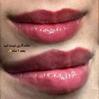 شیدینگ لب ، بن مژه ، میکرو ، سایه ابرو