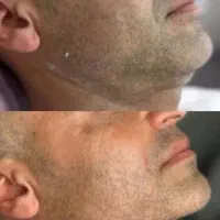 شما برندترین کلینیک زیبایی درایران را پیدا کردید|خدمات آرایشگری و زیبایی|کاشان, میدان کهنه|دیوار