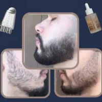 تونیک رویش ریش