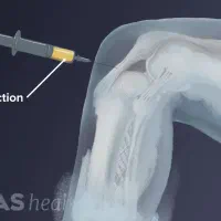 خدمات زیبایی درمنزلPRP دست صورت