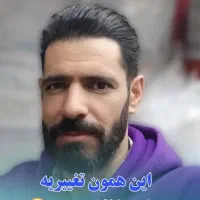 تخفیف ویژه کاشت مو فقط با   15 تومن