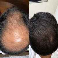 اکه میخوای موهات پریشت شه به من اعتماد کن|آرایشی، بهداشتی، درمانی|قم, باغ شازده|دیوار