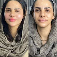 فول فیس رئوفیل ۵۰۰۰ توسط پزشک فقط به مدت 2روز