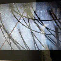 آموزش جامع اسکراب اسکالپ