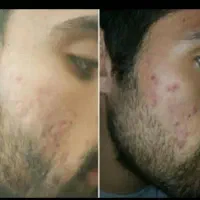 کرم معجزه شب اصل رفع لک وجوش وسفیدشدن پوست|آرایشی، بهداشتی، درمانی|قم, چهار مردان|دیوار