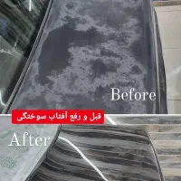 رفع آفتاب سوختگی