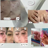پوستتو با ما ترمیم کن|آرایشی، بهداشتی، درمانی|شیراز, ستارخان|دیوار