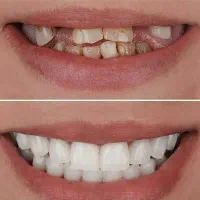 کلیه خدمات دندانپزشکی . زیبایی|خدمات آرایشگری و زیبایی|رشت, گلسار|دیوار